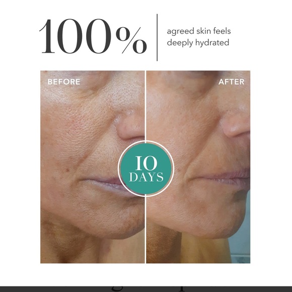 Algenist Travel Algae Peptide Regenerative Moisturizer 10ml NIB - Picture 4 of 6